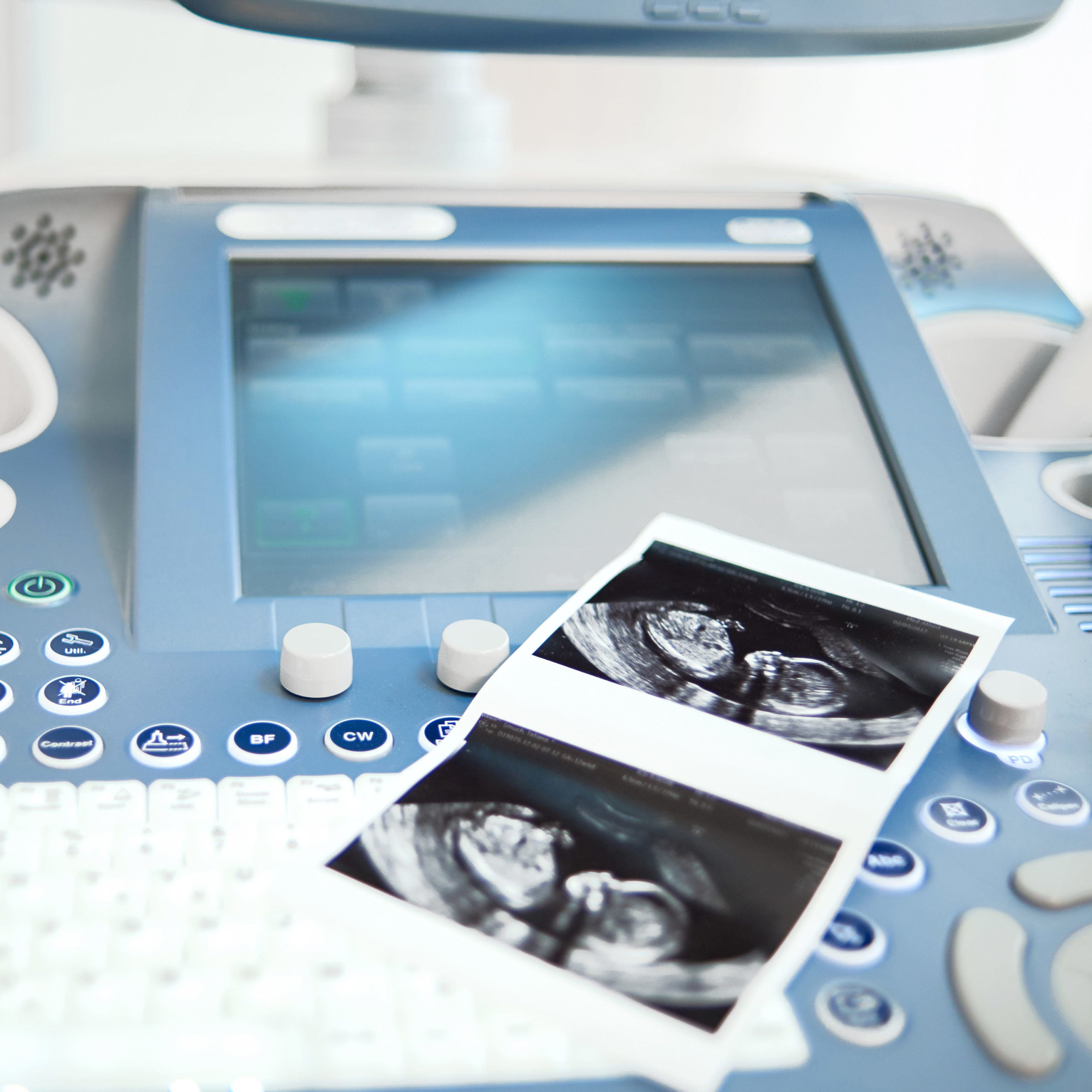 Sonography Tests