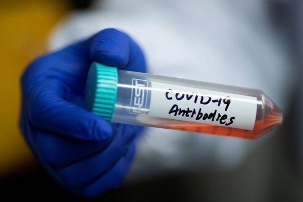 COVID -19 Antibody Package